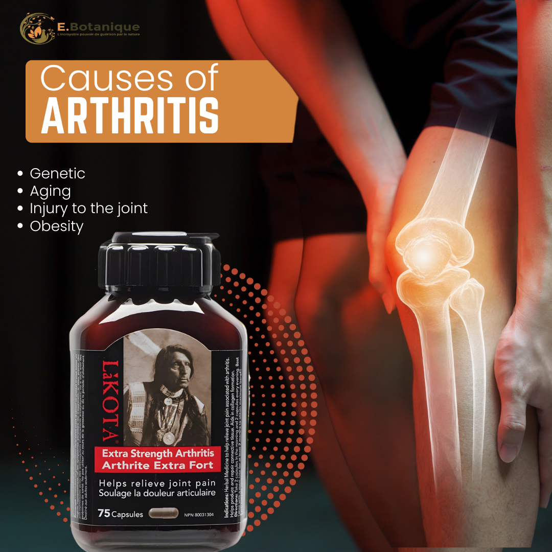 Complement Alimentaire Lakota - Douleurs articulaires et arthritiques extra forte