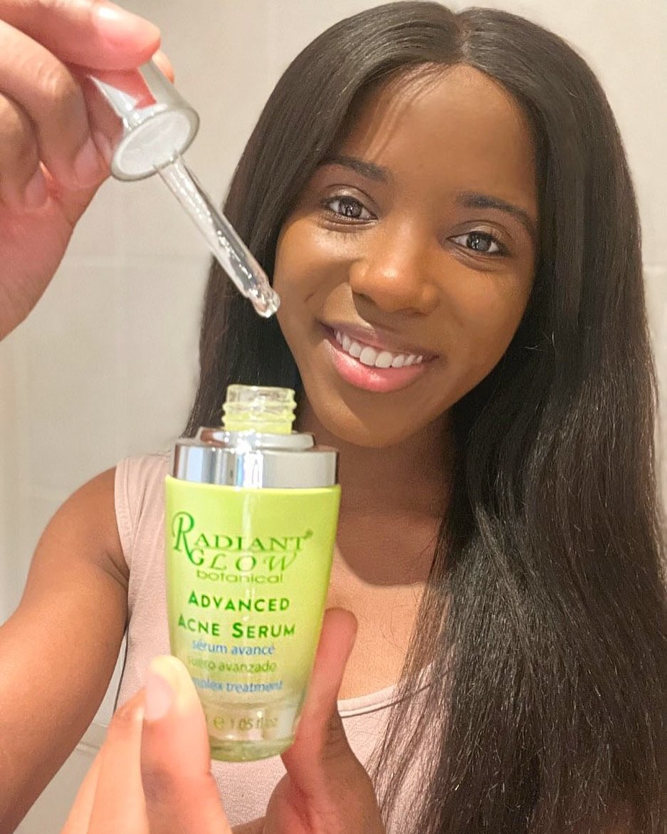 RADIANT GLOW BOTANICAL ADVANCED ACNE SERUM. Clarify and Calm acne-prone skin - Hydrate & Fresh feeling fresh